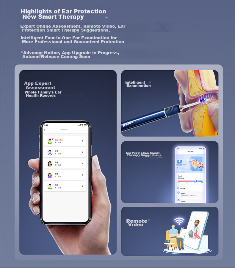 Bebird Note5 Умный визуальный инструмент для чистки ушей, устройство для чистки ушей, пинцет, инструмент для осмотра ушей, цвет "Ледниковый белый"