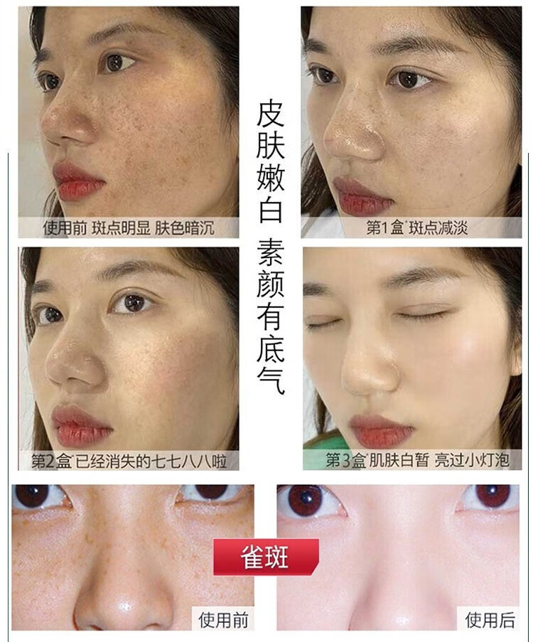 广药白云山美白祛斑霜溶斑淡化斑点老年斑雀斑黄褐斑妊娠斑面部去斑30g
