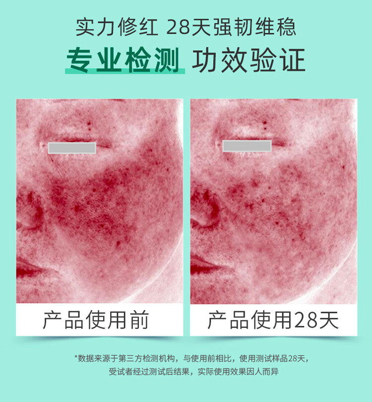 植物医生积雪草舒缓特护喷雾爽肤水随时补水保湿 积雪草舒缓特护喷雾99ml*3支