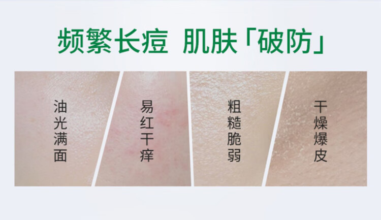 后美博士积雪草泡泡面膜3盒 深层清洁毛孔去黑头闭口粉刺小气泡涂抹泥膜 