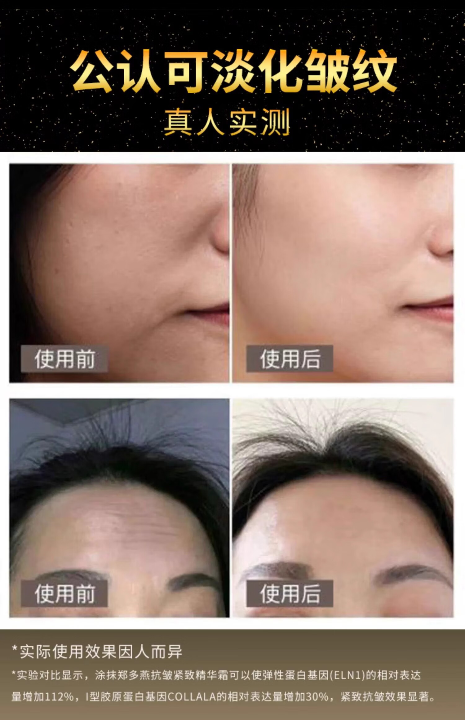 本然妍直播同款DYZ郑多燕胶原蛋白粉紧致抗皱精华粉填充粉精华升级版5.0 名媛贵妇5.0版本【到手4盒】