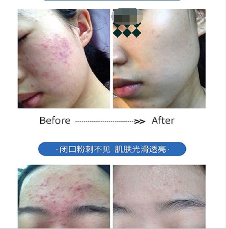 广药白云山氨基酸洗面奶痘痘黑头粉刺控油收缩毛孔深层清洁500ml