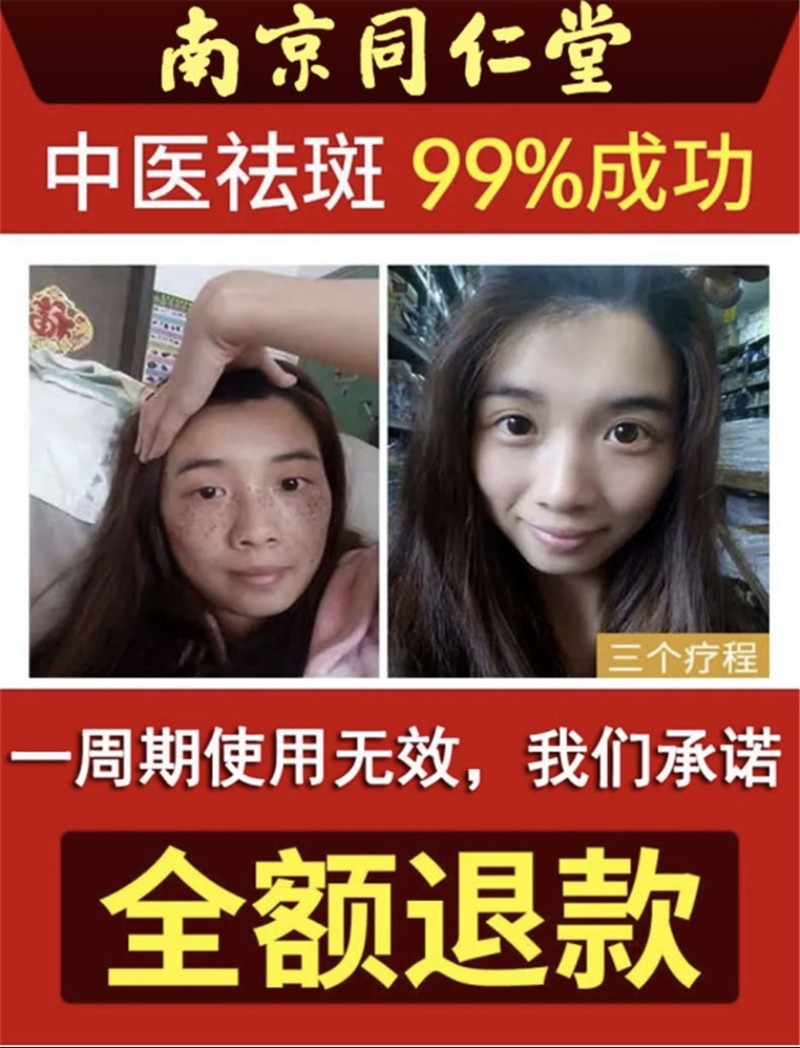 碧索娜（BISUONA）南京同仁堂美白祛斑霜去斑霜去雀斑老年斑晒斑黑斑黄褐斑妊娠斑淡化男女士面部祛斑产品30g