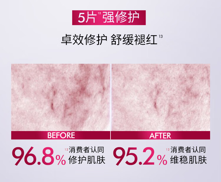 欧莱雅安瓶面膜 淡化细纹 玻尿酸补水保湿 护肤品 礼物送女友送闺蜜 【明星面膜】安瓶面膜15片