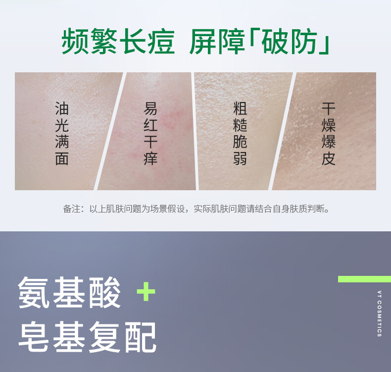 VTCICA老虎洗面奶300ml/支18枚老虎痘痘贴深层清洁净痘修护套组