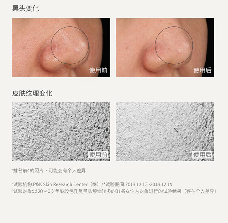 悦诗风吟火山泥毛孔净澈深层清洁泥膜100ml  面膜收缩毛孔 去黑头男女士