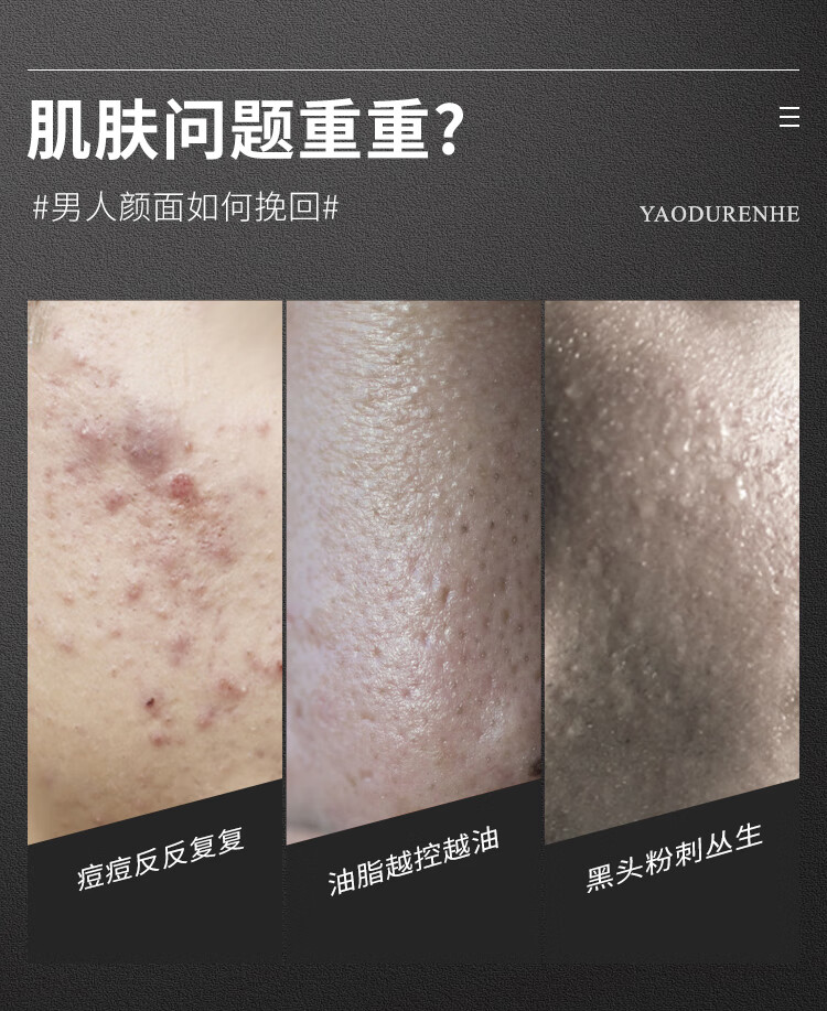 仁和匠心洗面奶男士除螨控油祛 痘深层清洁细致毛孔男女洁面乳洗去油腻植物氨基酸150g