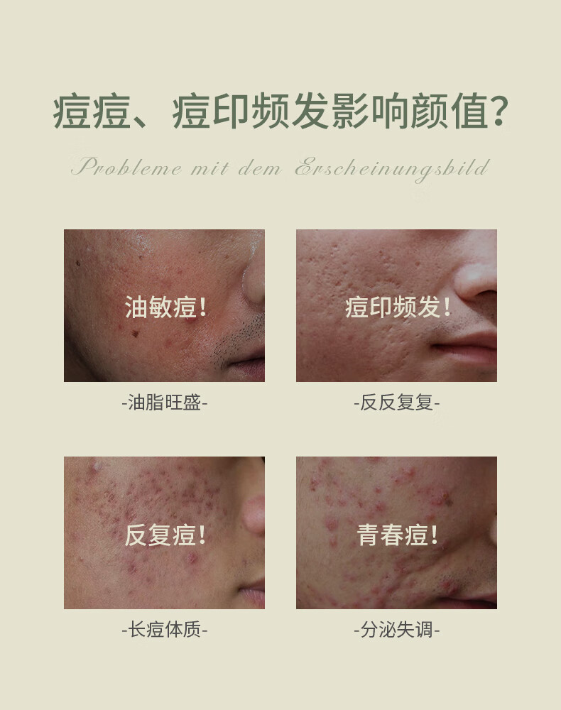 SKISGEM 德国进口祛痘精华膏淡化痘印痘坑修复凝胶芦荟胶女男士 【轻度痘痘】祛痘修复膏/30g