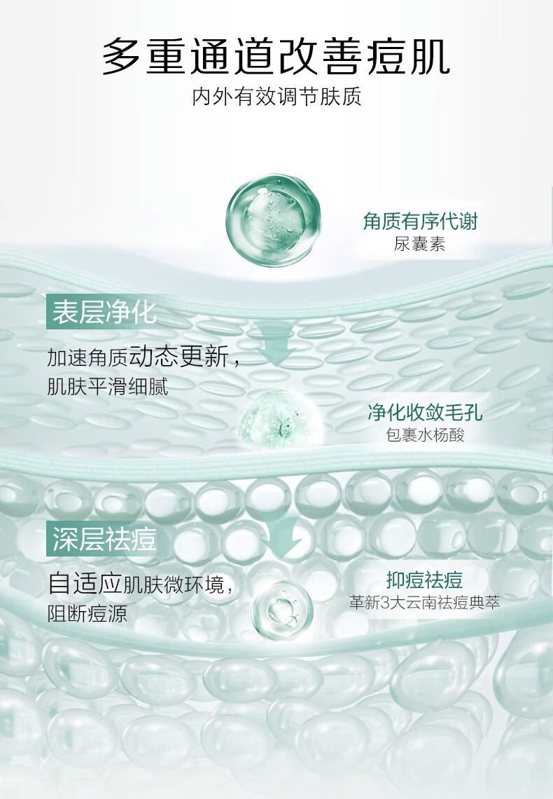 NHFOUYOU祛痘精华液修复淡化痘印痘坑青春痘祛痘疤闭口收缩毛孔油痘女男士 1瓶【体验装】30ml