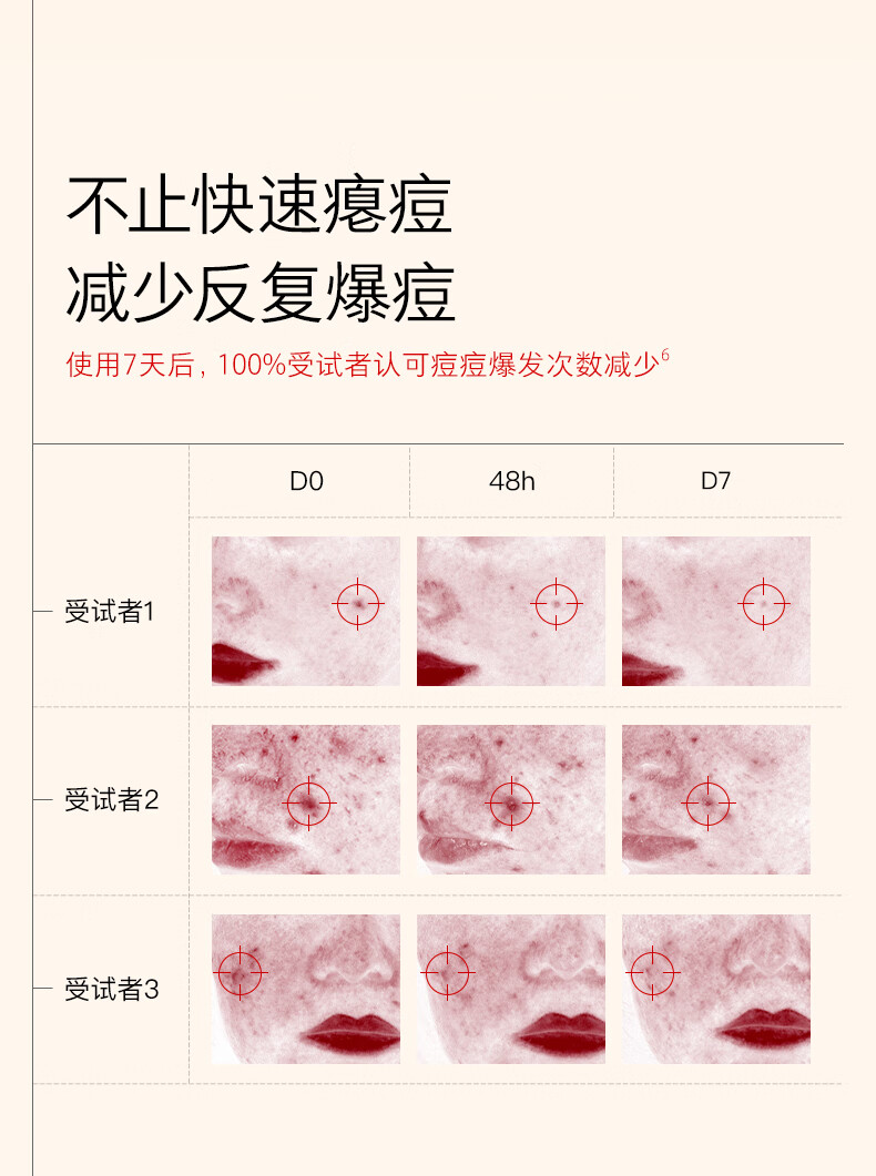 HomeFacialPro双酸精准祛痘精华液15ml  hfp小红帽去痘补水男修复肌肤礼物女