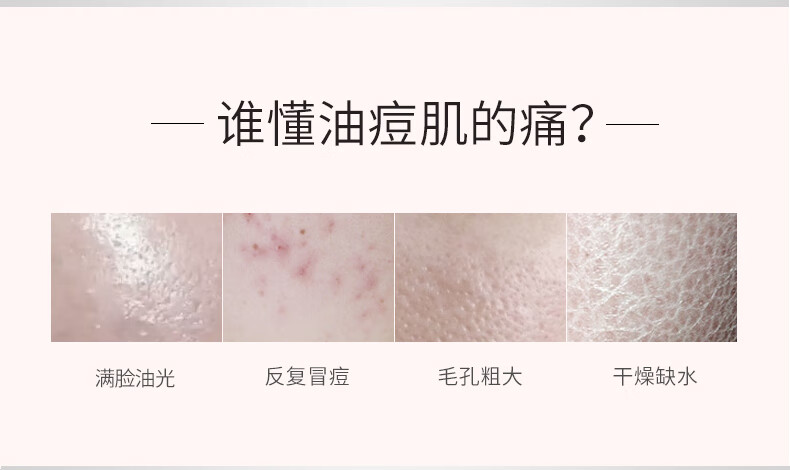 露得清 美国原产0.5%水杨酸祛痘乳液 清爽保湿修护温和118ml 纯净护肤