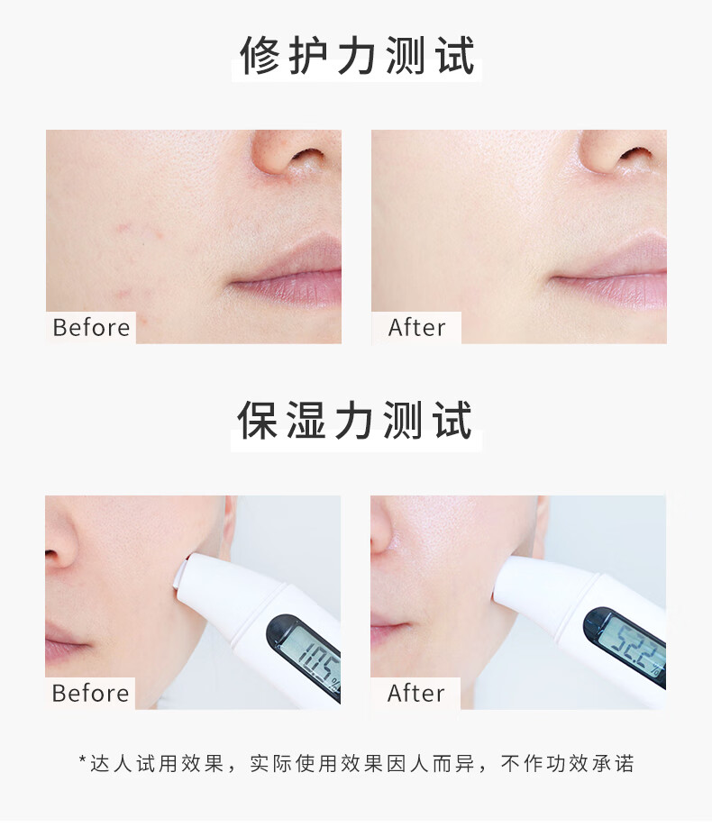 稚优泉 角鲨烷面膜30片免洗补水精华淡化痘印舒缓修护清洁保湿