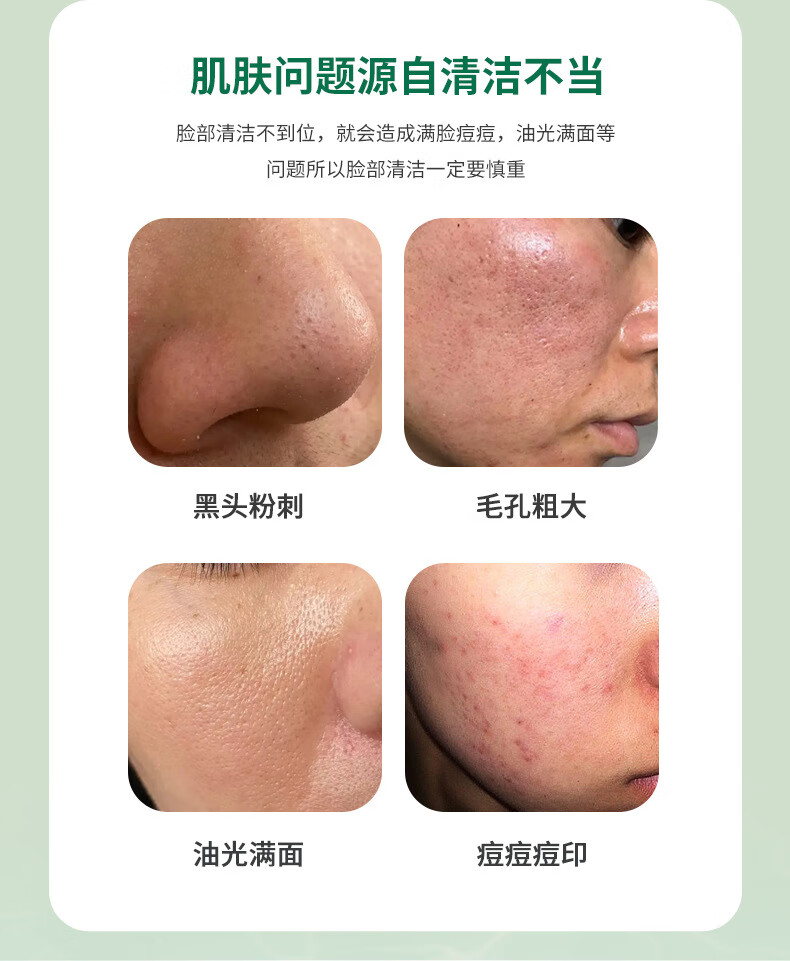 珂卡薇积雪草泡泡面膜去黑头毛孔收缩闭口清洁深层涂抹面膜男女48g