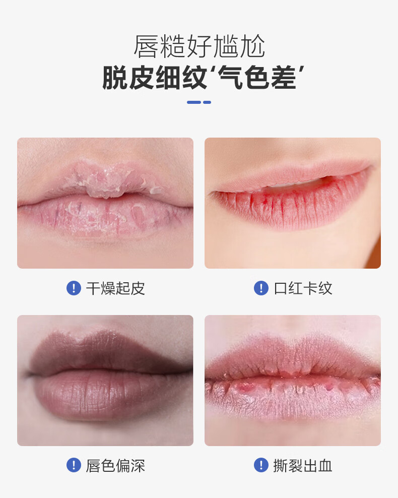 Vancilin经典修护唇膏唇膜防干燥脱皮凡士林润唇膏淡化唇纹经典香味7g