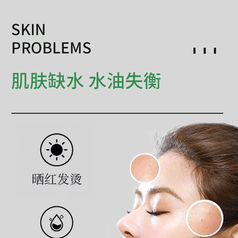 妍瑟 进口芦荟胶300ml*3 补水保湿控油平衡晒后护理淡化痘印痘坑芦荟面霜膏男女