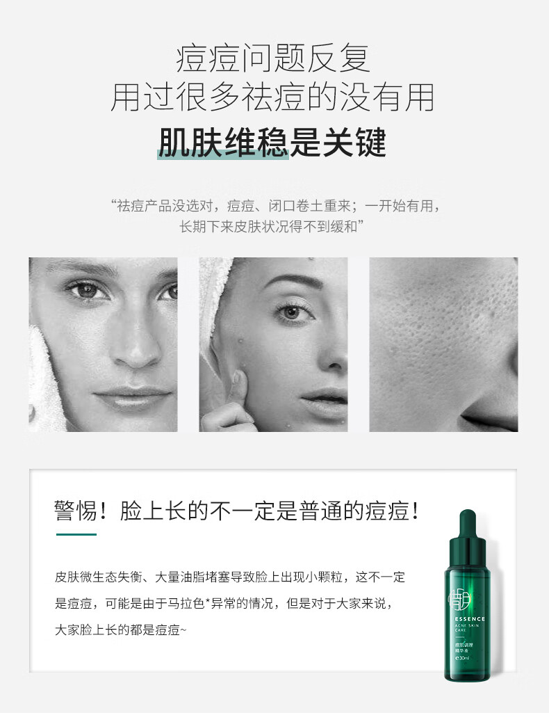 惜玥祛痘精华液30ml水杨酸精华去闭口粉刺青春痘淡化痘印控油修护痘痘