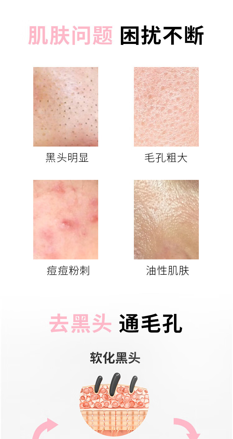 苏泉（Suquan）壬二酸15%凝胶和水杨酸细致毛孔霜任二酸乳软膏可搭配甲硝唑凝胶