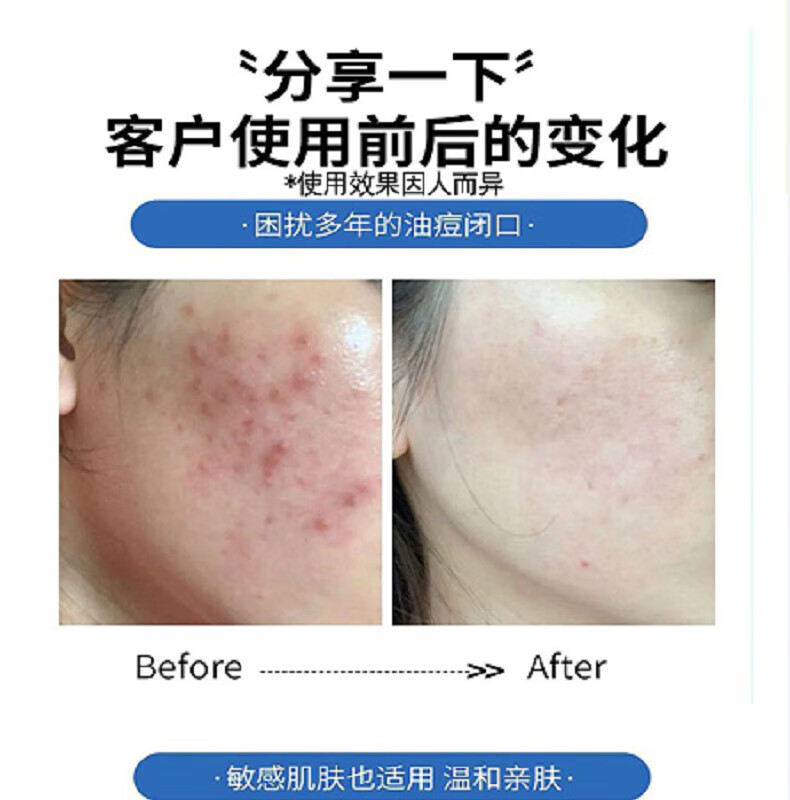 广药白云山氨基酸洗面奶痘痘黑头粉刺控油收缩毛孔深层清洁500ml