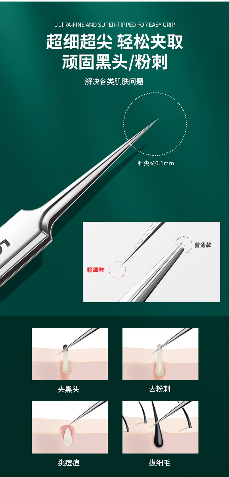 优家UPLUS 不锈钢5号细胞夹超尖粉刺针粉刺夹镊子盒装含酒精棉 黑头夹