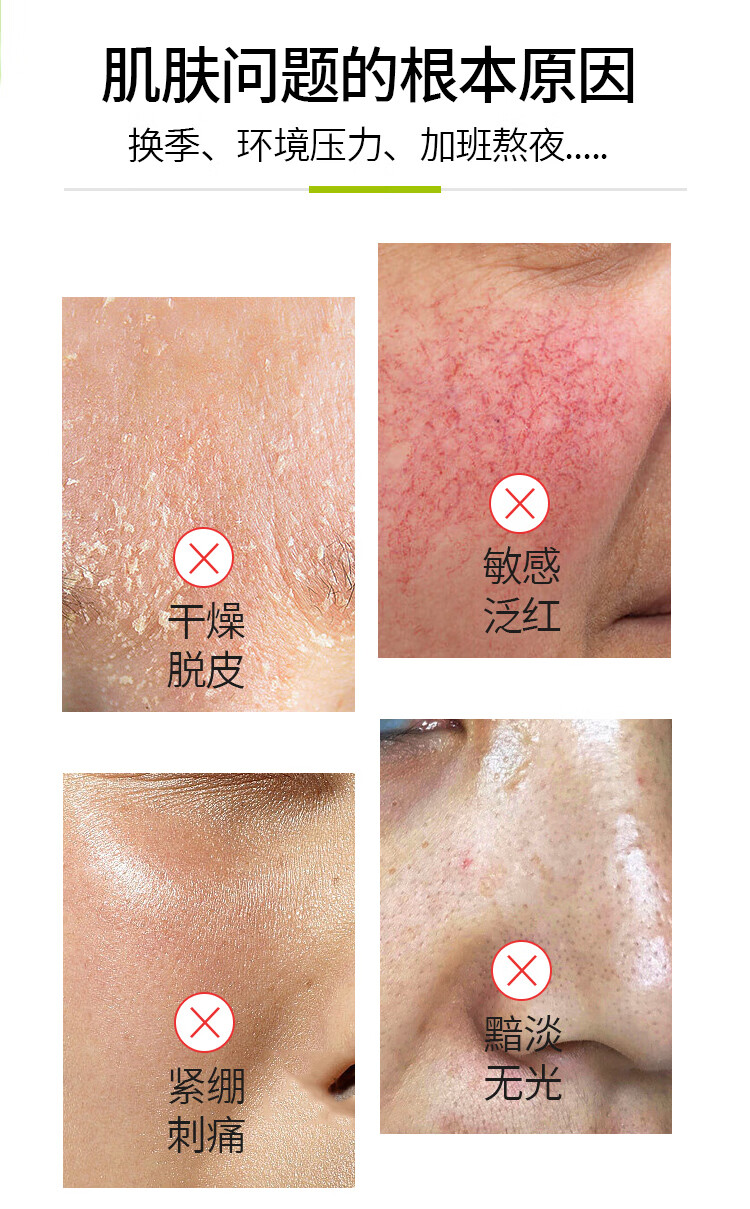 丁家宜面膜补水保湿面膜神经酰胺维稳皮肤屏障呵护舒缓敏感肌男女10片装