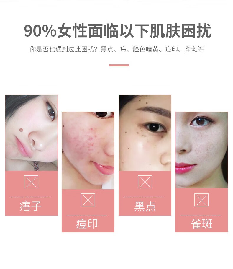 NHFOUYOU祛斑精华油点黑点玫瑰净颜精油补水美白提亮肤色溶斑精华美白淡斑 1瓶【体验装】
