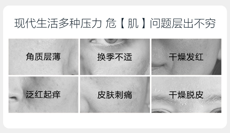薇诺娜舒敏特护霜5g