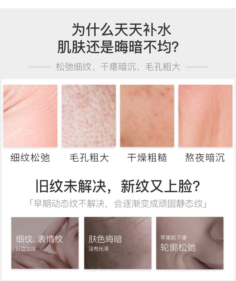 THE ORDINARY1%A醇角鲨烷视黄醇面部精华液滋润养肤抗皱改善保湿30ml纯净护肤 