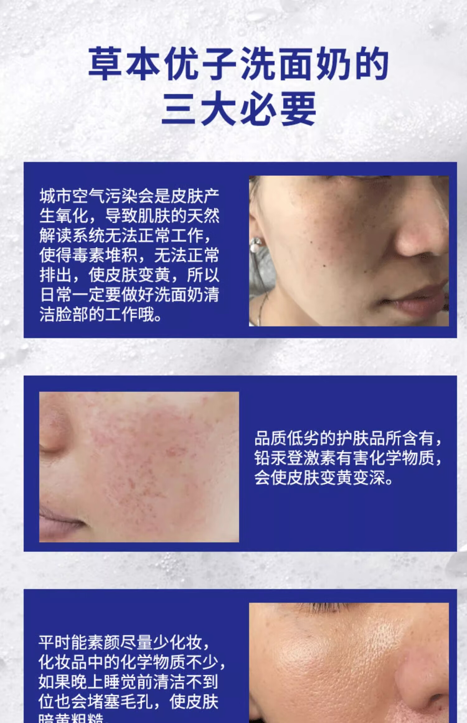 NHFOUYOU美白洗面奶女深层清洁收缩毛孔去黑头美白淡斑女士洁面乳男去角质 1瓶【新客户体验装】