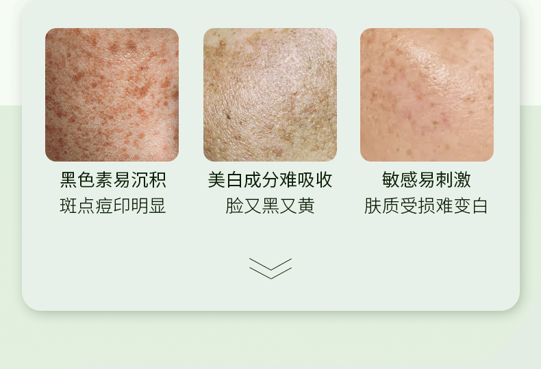 同仁堂祛斑霜淡斑美白去斑淡化黑色素提亮男女士50g