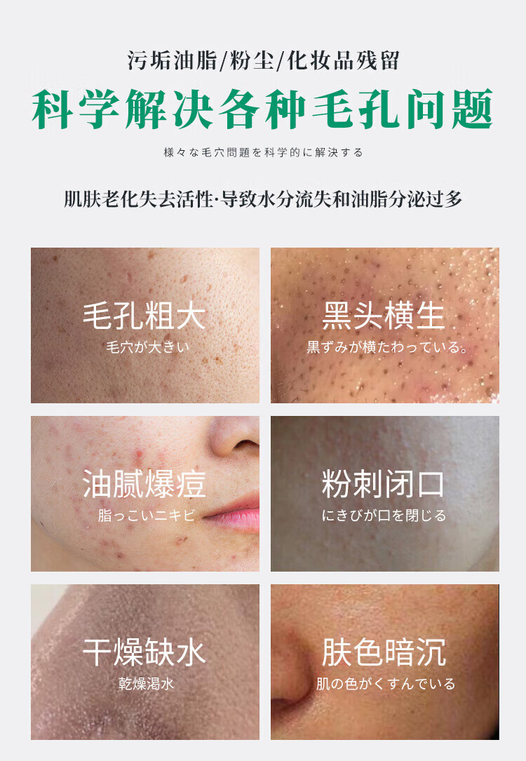 NHFOUYOU毛孔收缩毛孔精华液去黑头毛孔粗大闭口粉刺敏感肌草本优子 【轻微毛孔】1瓶装+赠品