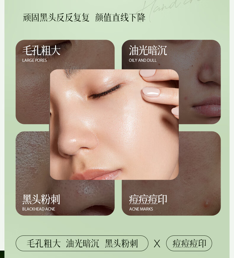 ORGINESE欧橘积雪草泡泡面膜水杨酸毛孔清洁泥膜去黑头闭口粉刺补水