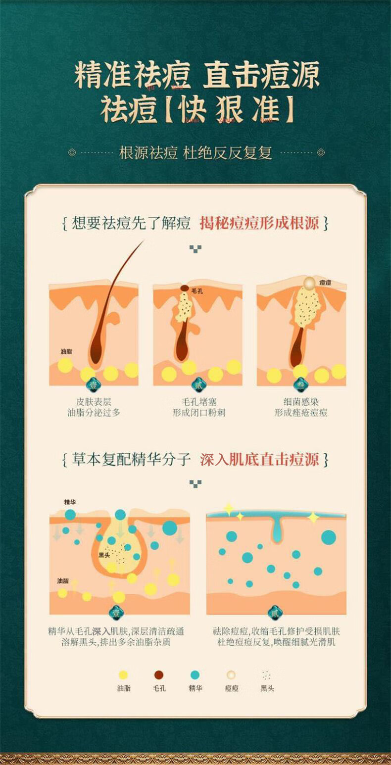 广药白云山祛痘膏淡化痘印草本茶树祛痘青春痘闭口粉刺抗痘祛痘凝胶女30g