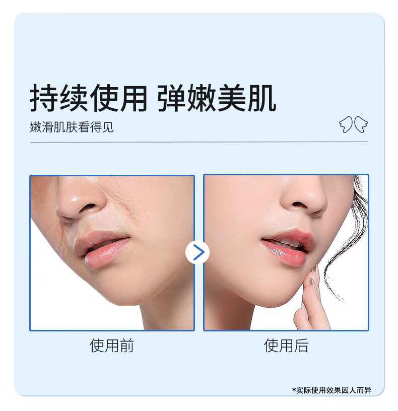 STVKG微晶多效紧致法令纹贴提拉紧致改善八字细纹表情纹面膜贴5对/盒