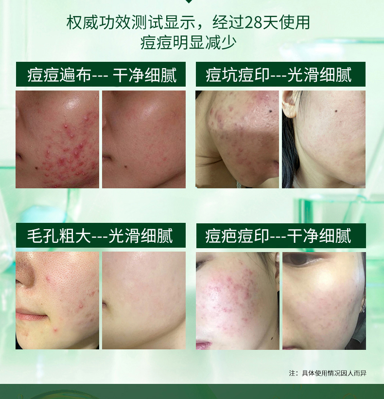 美颜笔记水杨酸洗面奶南方医科大学洗面奶男控油祛痘痘印去黑头女士120ml