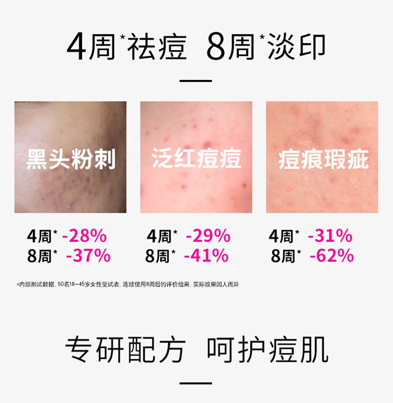 薇姿VICHY净颜无瑕祛痘保湿焕肤精华乳50ml(水杨酸 控油抑痘护肤品）