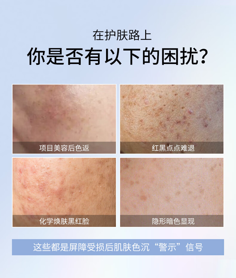 优斐斯（uface）氨甲环酸精华液传明酸5%高浓度提亮肤色 淡化色沉礼物 4ml 试用体验装