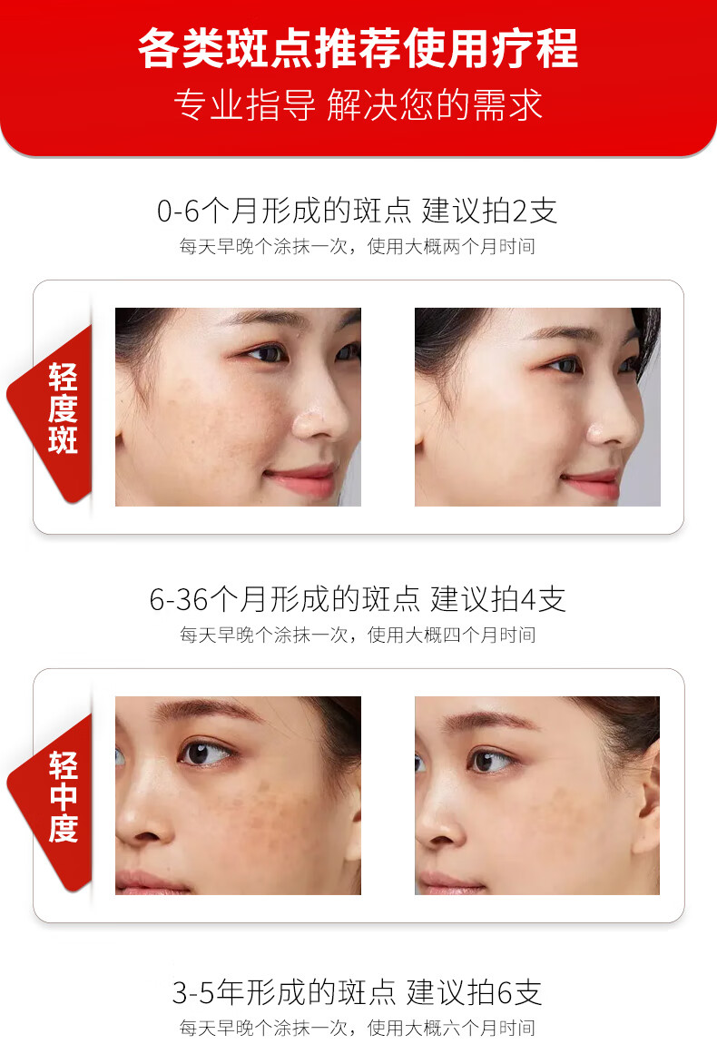 倩滋（QIANZI）OMENFEE美白祛斑霜去斑产品淡化黑色素提亮肤色保湿护肤面霜20g
