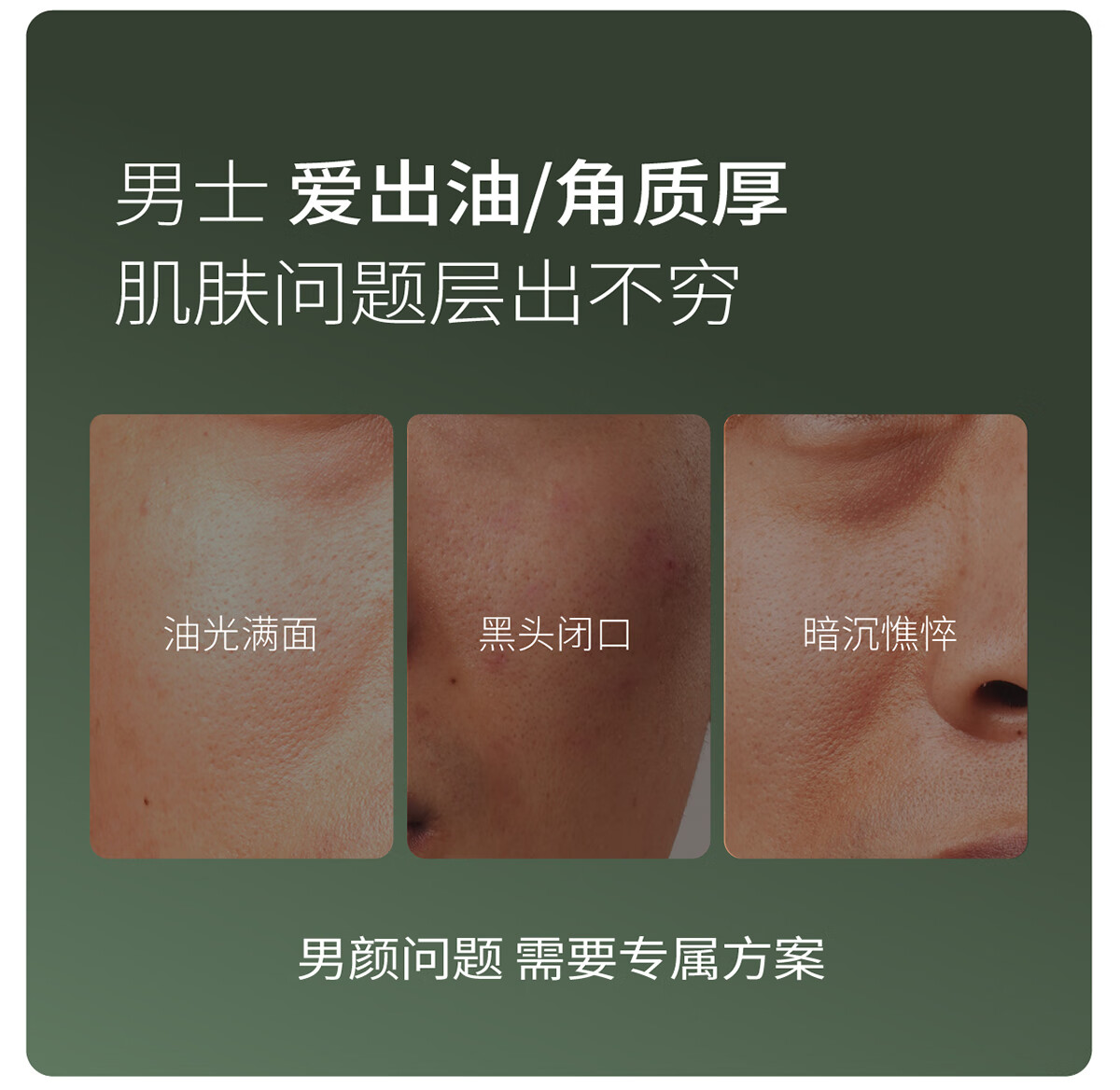 半亩花田男士水乳套装护肤品爽肤水洗面奶补水保湿控油祛痘礼盒 送男友