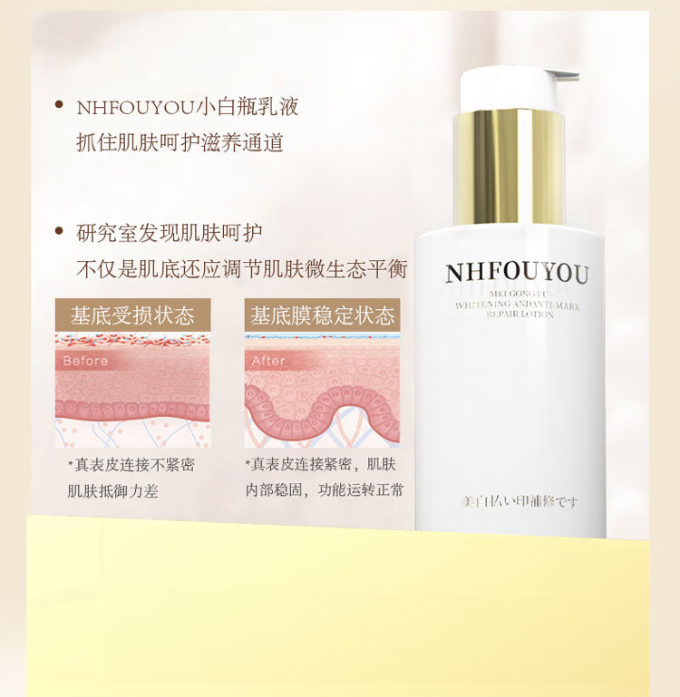 NHFOUYOU祛痘膏祛痘印修复淡化痘印痘坑青春痘美攻芙美白祛印修护乳液 1瓶【轻度痘痘】