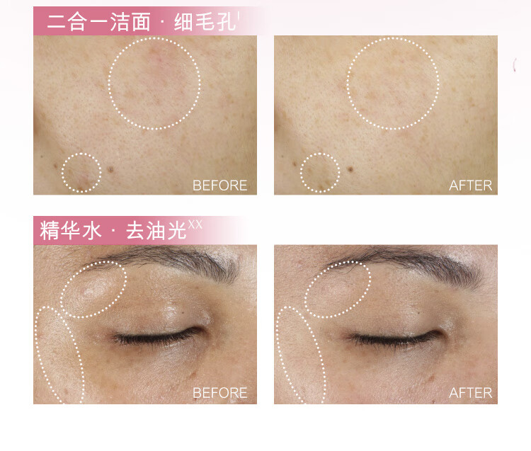 雅诗兰黛红石榴护肤套组（洁面30ml+红石榴水30ml+红石榴乳液30ml)护肤品