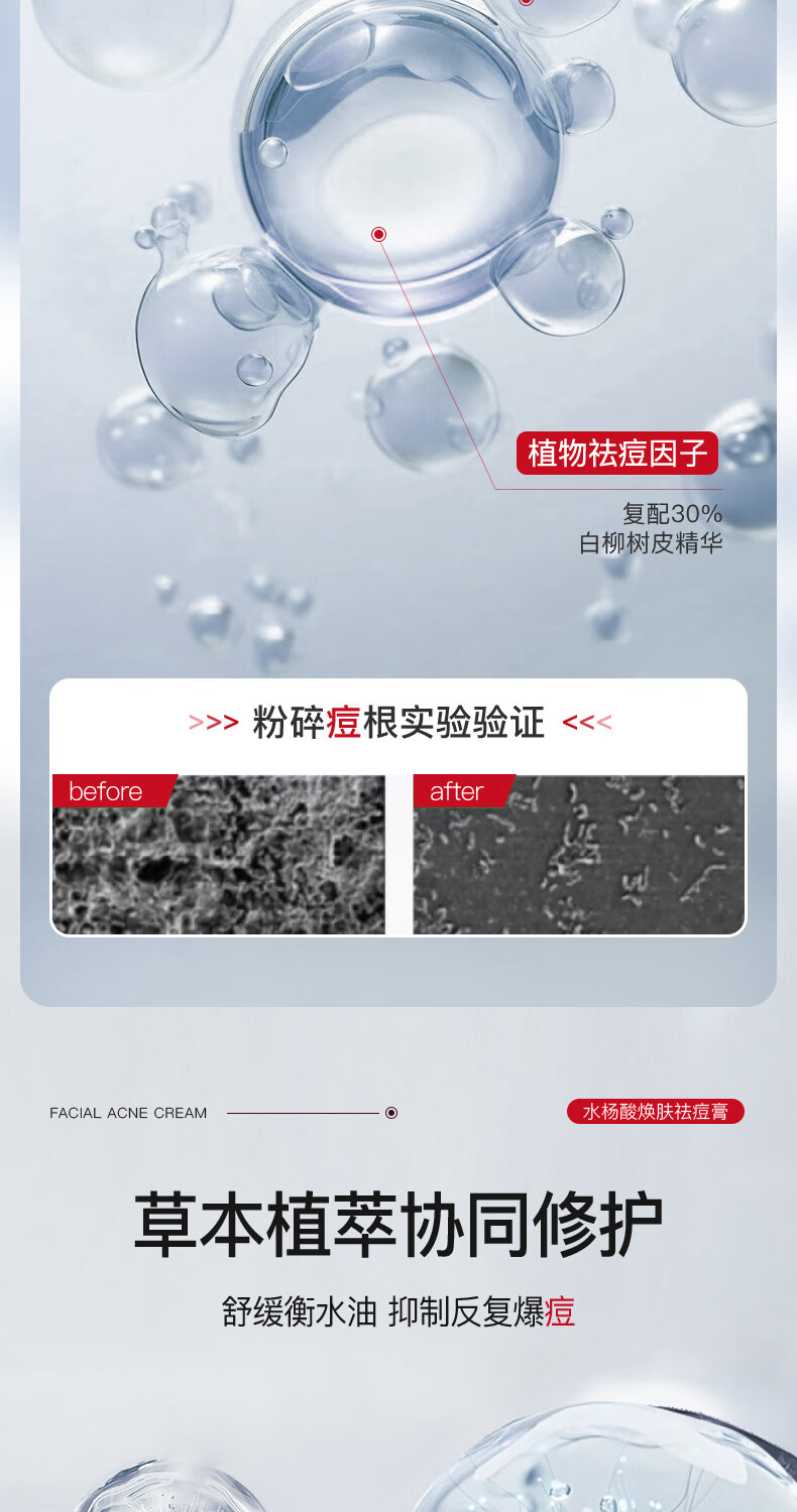 氧诗恋水杨酸焕肤祛痘膏修护淡化痘痘印去痘和痘印修护痘坑闭口粉刺50g