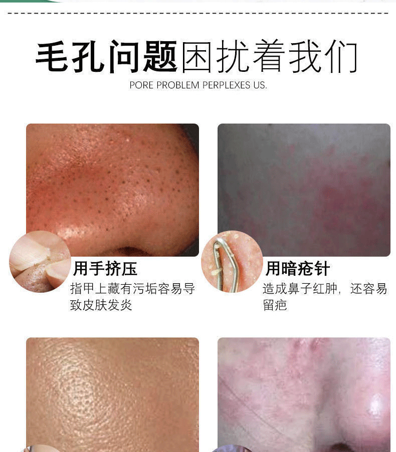 白云山爽肤水乳糖酸金盏花收缩毛孔粗大男女士补水保湿精华原液400ml
