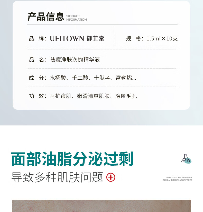 MOZOV祛痘精华液去痘痘和痘印修复痘坑闭口粉刺壬二酸水杨酸精华10支装