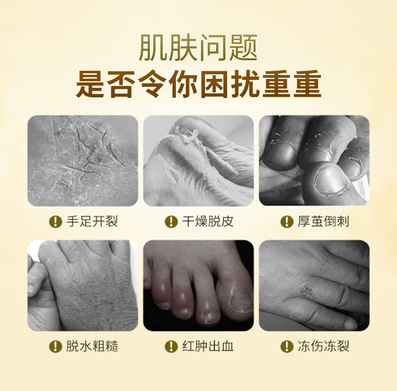 sakose进口马油手足防裂膏50g秋冬手脚后跟干裂皲裂保湿补水护手霜男女