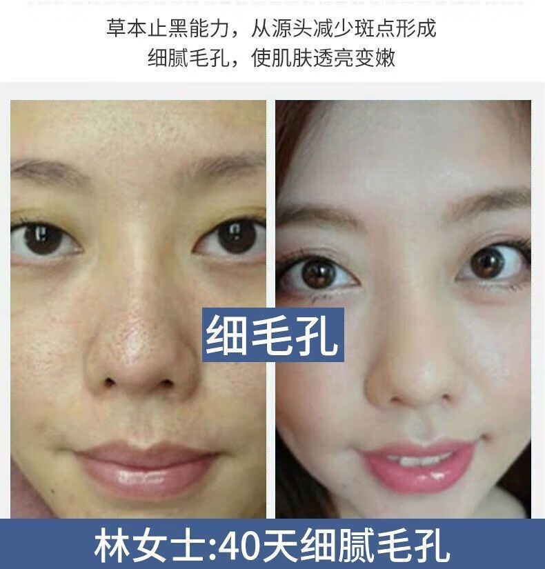 YMVLSD美白洗面奶烟酰胺净颜小野美白洁面乳博士控油改善暗沉亮肤洗面奶