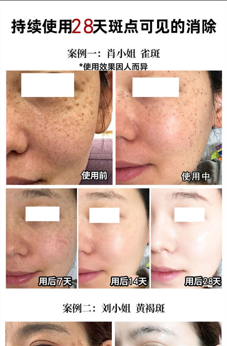 白云山美白祛斑精华液祛斑产品男女烟酰胺去黄淡化去斑溶斑油100ml