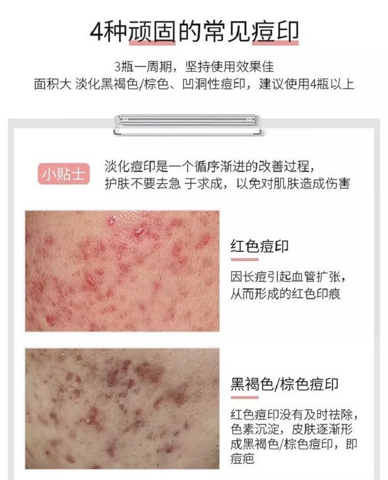 白云山祛痘膏痘印痘坑修护痘肌青春痘祛痘产品30g