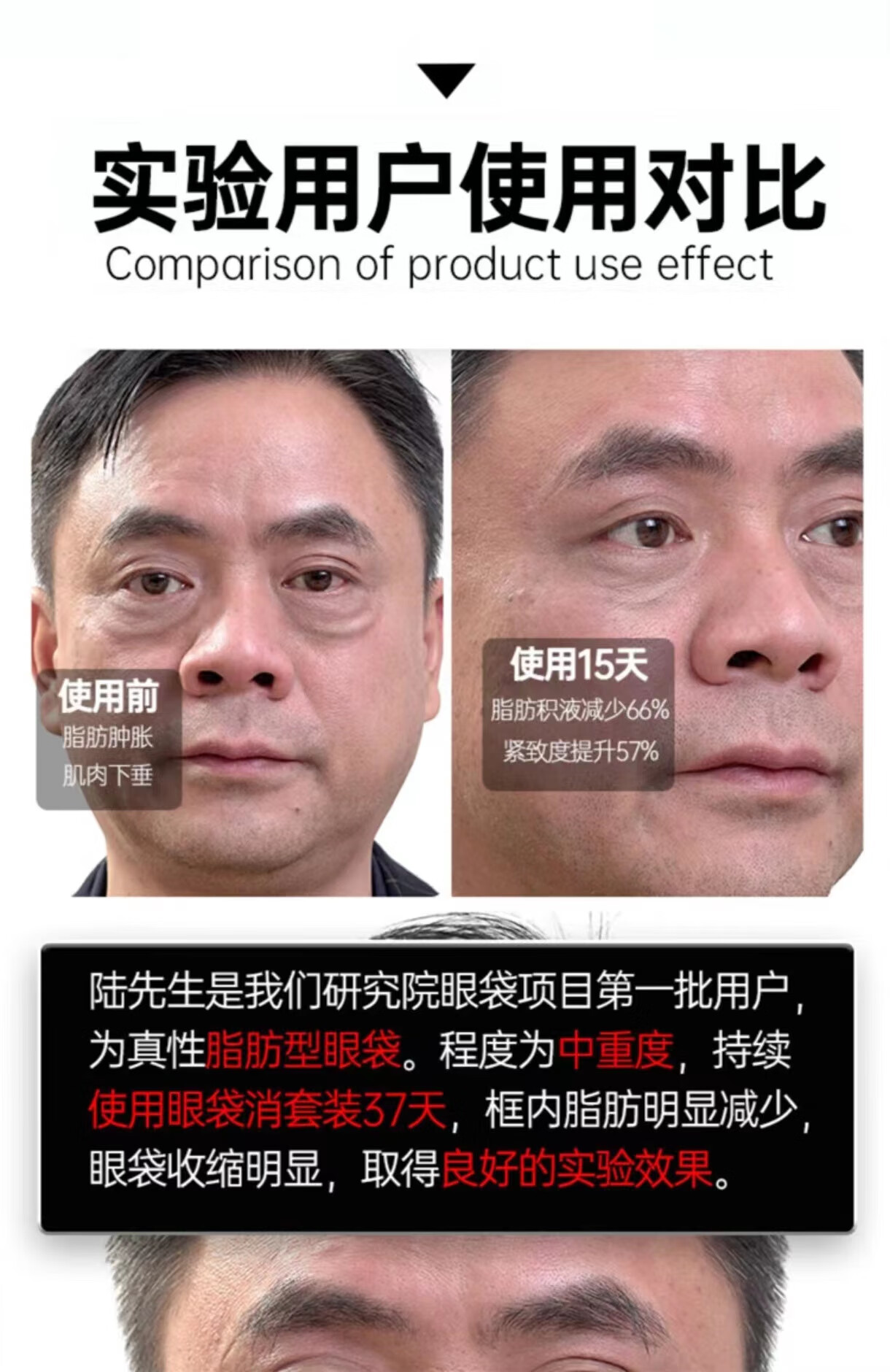 同仁堂类蛇毒眼霜眼袋黑眼圈淡化细纹皱纹提拉紧致补水保湿呵护眼周30g