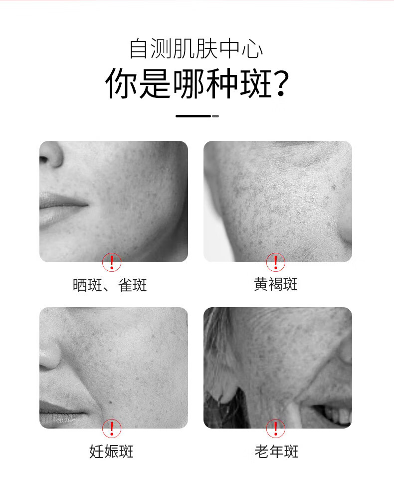 ZiBeak美白祛斑霜4盒装 烟酰胺祛斑肤研美白淡化斑点去斑提亮肤色