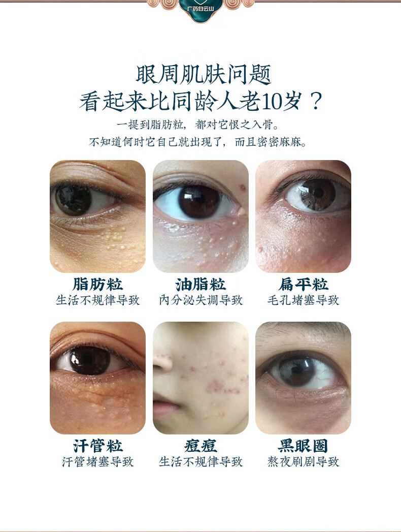 拜迪生物脂肪粒颗粒清肌精华液30ml 眼霜淡化黑眼圈抗皱纹提拉紧致